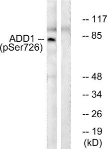 Western blot analysis of lysates from HeLa cells treated with Forskolin 40nM 30' using Anti-ADD1 (phospho Ser726) Antibody The right hand lane represents a negative control, where the antibody is blocked by the immunising peptide