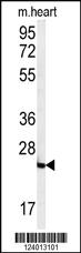 Anti-FOLR2 Rabbit Polyclonal Antibody