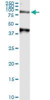 Anti-ARSA Polyclonal Antibody Pair