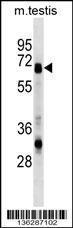 Anti-ASNS Rabbit Polyclonal Antibody (FITC (Fluorescein Isothiocyanate))