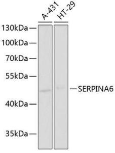 Anti-Cortisol Binding Globulin Rabbit Polyclonal Antibody