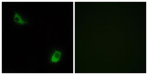 Immunofluorescence analysis of LOVO cells using Anti-FPRL2 Antibody. The right hand panel represents a negative control, where the antibody was pre-incubated with the immunising peptide