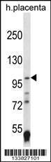 Anti-EPAS1 Rabbit Polyclonal Antibody (APC (Allophycocyanin))