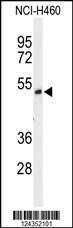 Anti-FXRD1 Rabbit Polyclonal Antibody