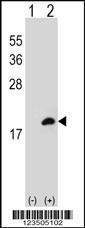 Anti-COTL1 Rabbit Polyclonal Antibody (FITC (Fluorescein))