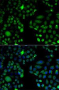 Immunofluorescence analysis of U2OS cells using Anti-EPC1 Antibody (A11881) DAPI was used to stain the cell nuclei (blue)