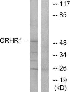 Antibody anti-CRHR1 A96076-100 100 µg