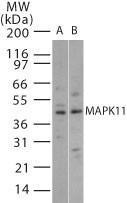 Anti-MAPK11 Rabbit Polyclonal Antibody