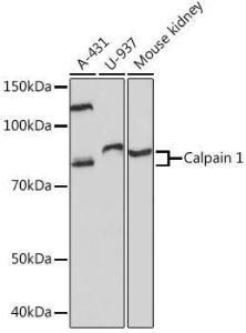 Western blot analysis of extracts of various cell lines, using Anti-Calpain 1 Antibody [ARC1272] (A305565) at 1:1,000 dilution. The secondary antibody was Goat Anti-Rabbit IgG H&L Antibody (HRP) at 1:10,000 dilution.