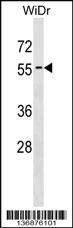 Anti-ATG4D Rabbit Polyclonal Antibody