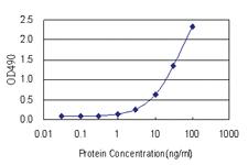 Anti-XRCC4 Polyclonal Antibody Pair