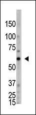 Anti-OASL Rabbit Polyclonal Antibody (APC (Allophycocyanin))