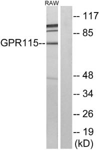 Western blot analysis of lysates from RAW264.7 cells using Anti-GPR115 Antibody. The right hand lane represents a negative control, where the antibody is blocked by the immunising peptide