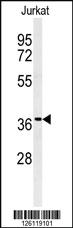 Anti-GNB1 Rabbit Polyclonal Antibody