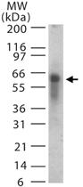 Anti-ASB3 Rabbit Polyclonal Antibody