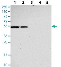 Anti-SLC24A6 Rabbit Polyclonal Antibody