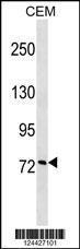 Anti-CCNF Rabbit Polyclonal Antibody (AP (Alkaline Phosphatase))