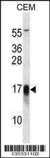 Anti-FXYD5 Rabbit Polyclonal Antibody (HRP (Horseradish Peroxidase))