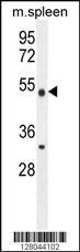 Anti-METTL4 Rabbit Polyclonal Antibody