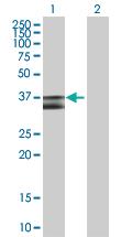 Anti-PDHB Mouse Polyclonal Antibody