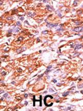 Anti-RB1 Rabbit Polyclonal Antibody (Biotin)