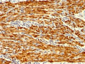 Immunohistochemical analysis of formalin-fixed, paraffin-embedded human uterus using Anti-Calponin 1 Antibody [SPM169]