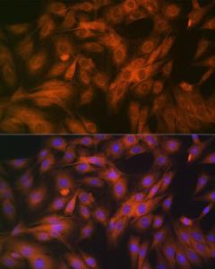 Immunofluorescence analysis of C6 cells using Anti-Calpain 1 Antibody [ARC1272] (A305565) at a dilution of 1:100 (40x lens). DAPI was used to stain the cell nuclei (blue).