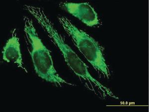 Anti-PDHB Mouse Polyclonal Antibody