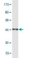 Anti-RAB7L1 Mouse Monoclonal Antibody [clone: 1B10]