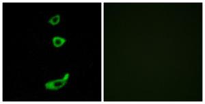 Antibody anti-CRHR1 A96076-100 100 µg