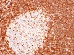 Immunohistochemical analysis of formalin-fixed, paraffin-embedded human tonsil using Anti-Bcl-2 Antibody [8C8]