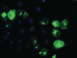 Anti-TFR2 Mouse Monoclonal Antibody [clone: OTI2B4]