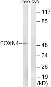 Western blot analysis of lysates from LOVO cells using Anti-FOXN4 Antibody. The right hand lane represents a negative control, where the antibody is blocked by the immunising peptide.