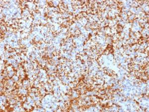 Immunohistochemical analysis of formalin-fixed, paraffin-embedded human spleen using Anti-Integrin beta 3 Antibody [ITGB3/2166R]