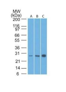 Western blot analysis of human HeLa, A549, and MCF7 cell lysates using Anti-Bcl-2 Antibody [8C8]