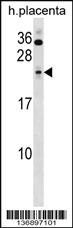 Anti-SAP30 Rabbit Polyclonal Antibody