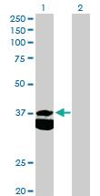 Anti-PDHB Rabbit Polyclonal Antibody