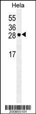 Anti-EIF4E Mouse Monoclonal Antibody (HRP (Horseradish Peroxidase)) [clone: 163CT48.1.9]