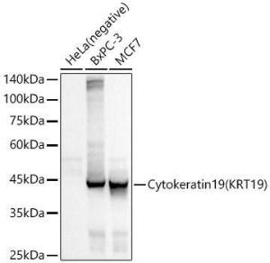 Western blot analysis of various lysates, using Anti-Cytokeratin 19 Antibody [ARC2811] (A307943) at 1:500 dilution The secondary antibody was Goat Anti-Rabbit IgG H&L Antibody (HRP) at 1:10,000 dilution Lysates/proteins were present at 25 µg per lane