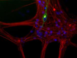 Mixed neuron/glia cultures from newborn rat brain stained with Anti-Peripherin Antibody (A85432/green) and Anti-NF-L Antibody (red) A class of large neurons