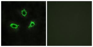 Immunofluorescence analysis of LOVO cells using Anti-GPR115 Antibody. The right hand panel represents a negative control, where the antibody was pre-incubated with the immunising peptide