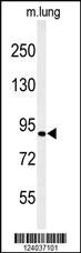 Anti-H6PD Rabbit Polyclonal Antibody