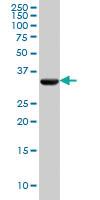 Anti-PDHB Mouse Monoclonal Antibody [clone: 2B2]