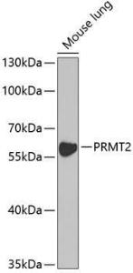 Western blot analysis of extracts of mouse lung, using Anti-PRMT2 / HMT1 Antibody (A11885) at 1:1,000 dilution. The secondary antibody was Goat Anti-Rabbit IgG H&L Antibody (HRP) at 1:10,000 dilution.