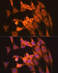 Immunofluorescence analysis of NIH-3T3 cells using Anti-Calpain 1 Antibody [ARC1272] (A305565) at a dilution of 1:100 (40x lens). DAPI was used to stain the cell nuclei (blue).