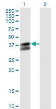 Anti-PDHB Mouse Monoclonal Antibody [clone: 2B2]