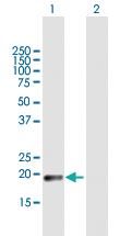 Anti-CLEC3A Mouse Polyclonal Antibody