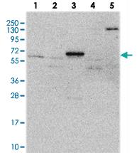 Anti-CCDC36 Rabbit Polyclonal Antibody