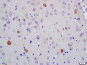 Anti-NFH Rabbit Polyclonal Antibody