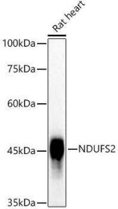 Anti-NDUFS2 Rabbit Monoclonal Antibody [clone: ARC3018]